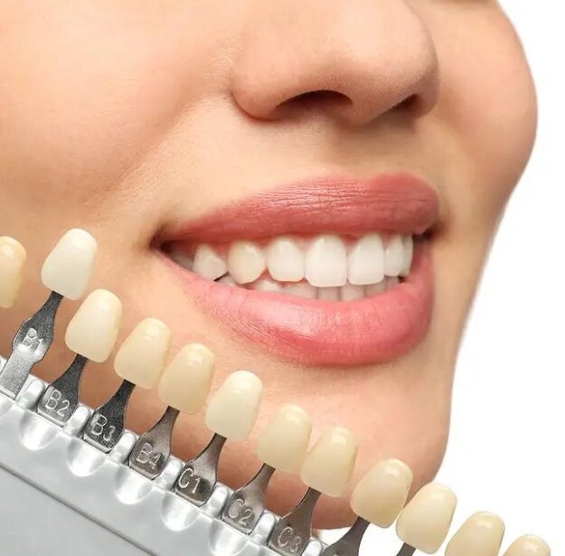 Cosmetic Dentistry طب الأسنان التجميلي